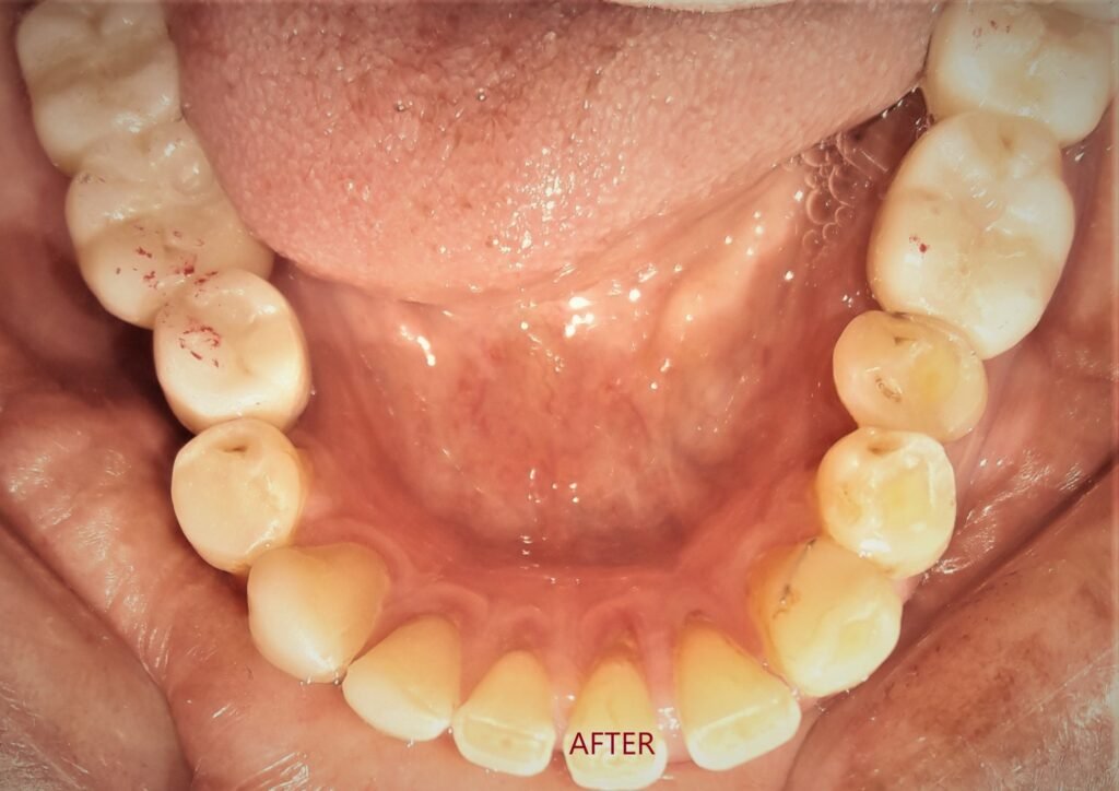 best-implant-doctor