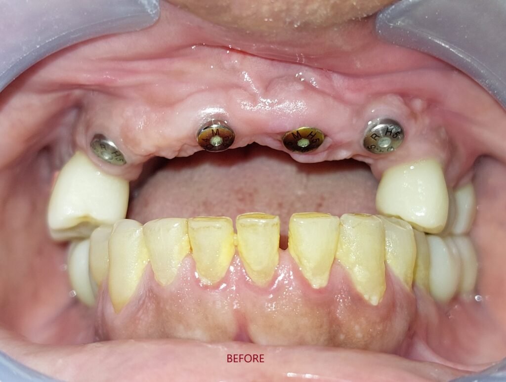 best-implant-clinic-dhaka