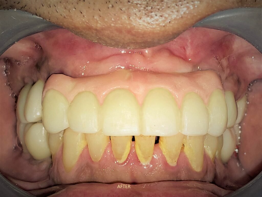 best-implant-clinic-dhaka