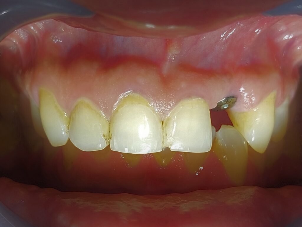 best-implant-dhaka