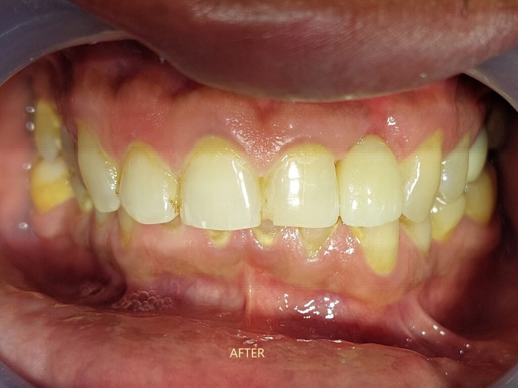 best-implant-dhaka