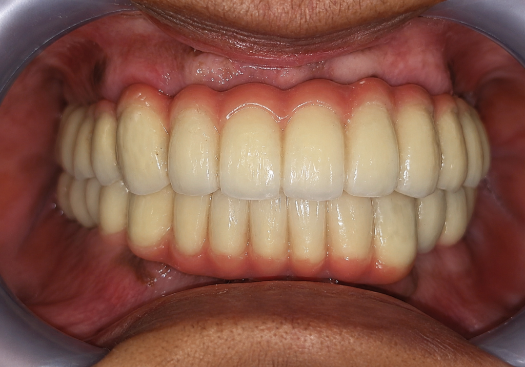 best-implant-clinic-dhaka