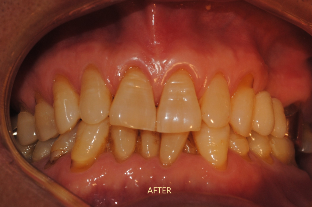 implant dentist dhaka