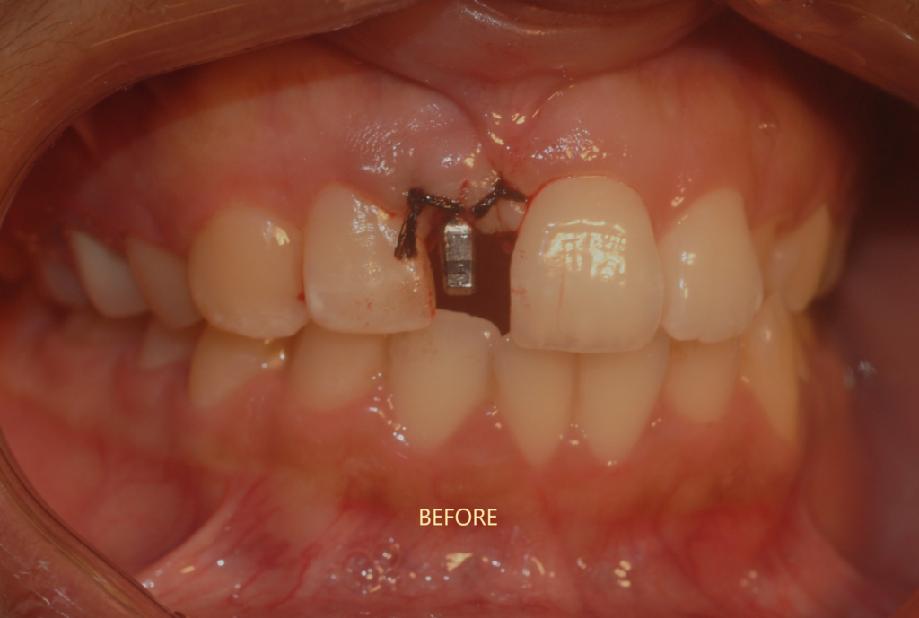 best-implant-clinic-uttara
