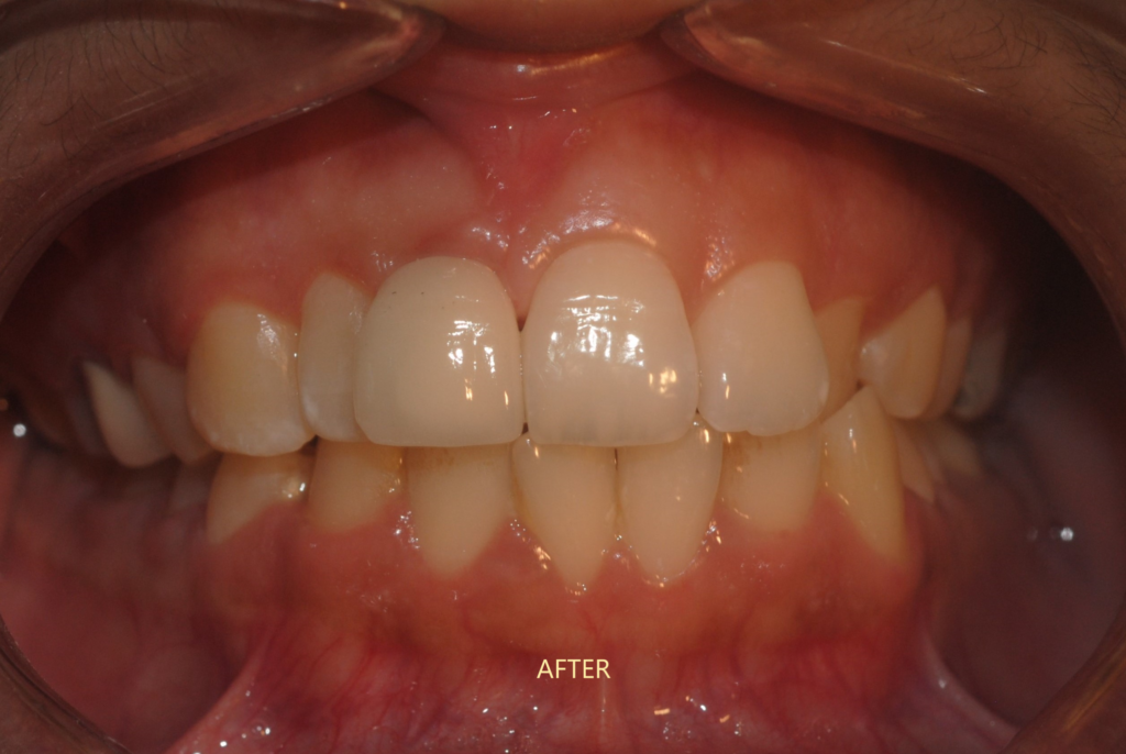 best-implant-clinic-uttara