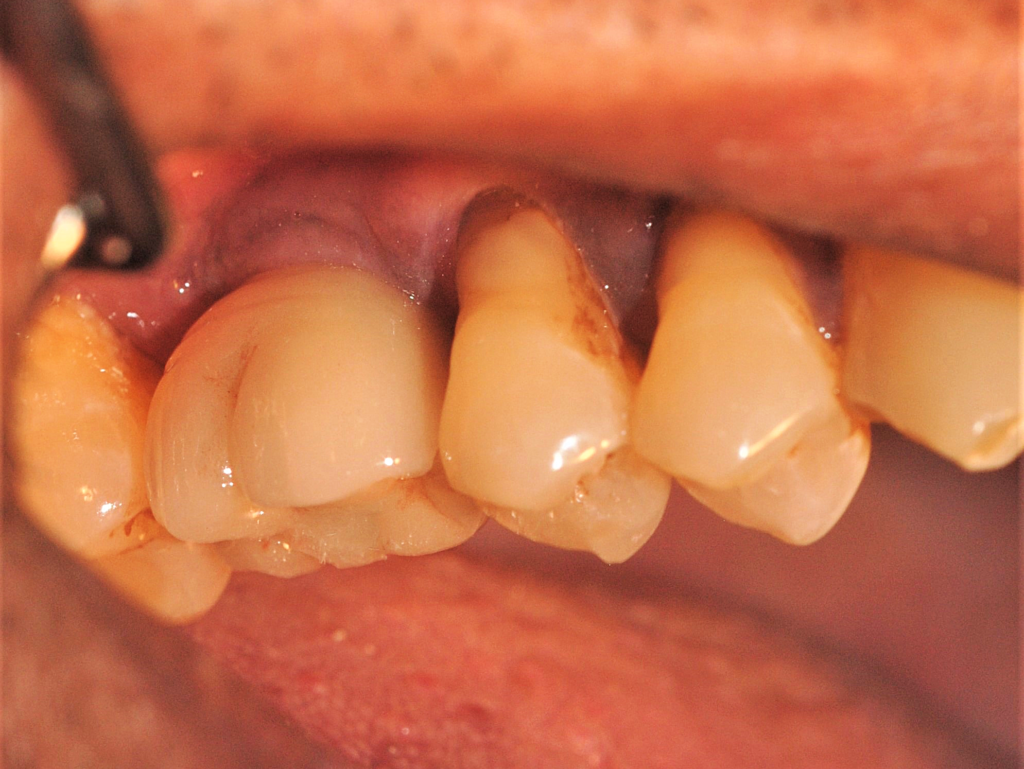 osstem-implant-dr-uttom
