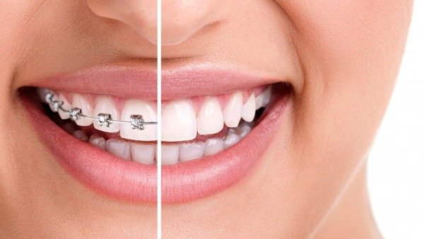 Orthodontist