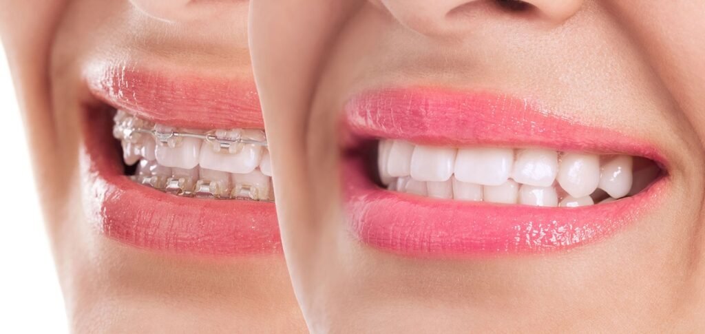braces doctor uttara