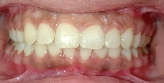 best orthodontist uttara