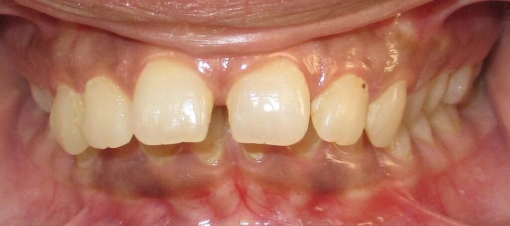 best orthodontist uttara