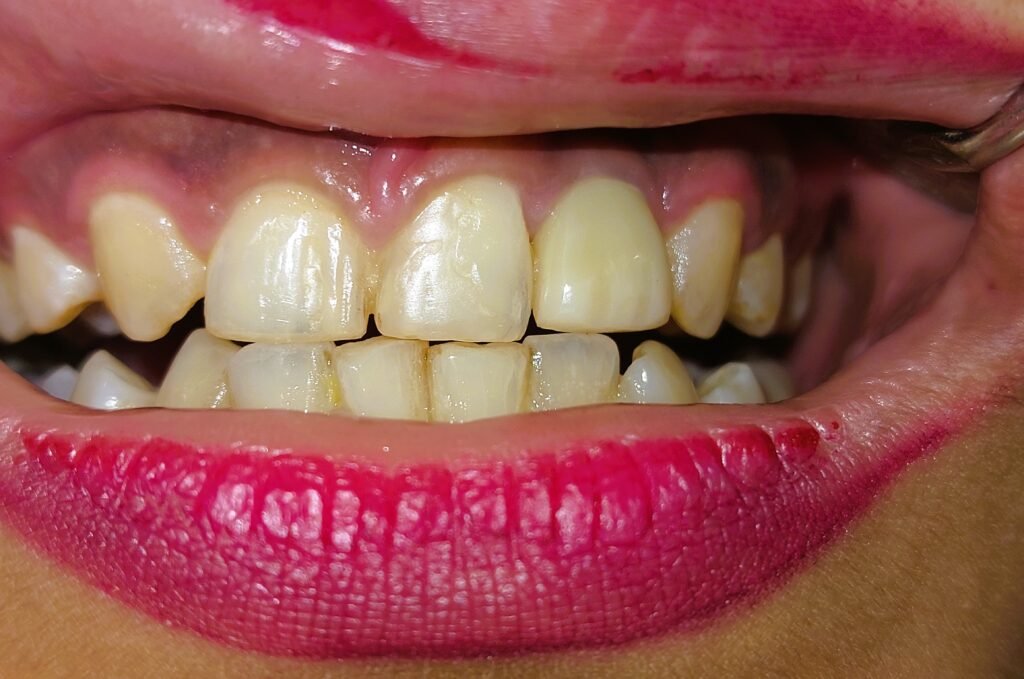 orthodontics and implant
