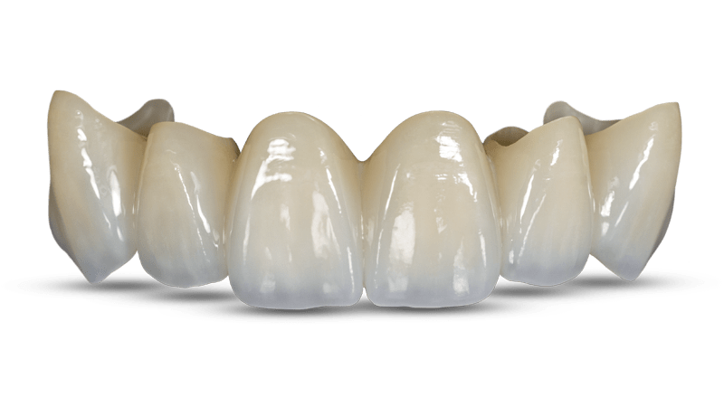 zirconium crown and bridge