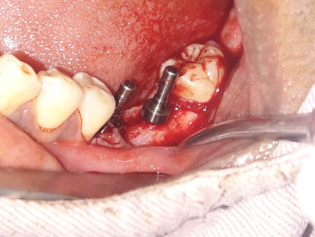 bone grat dr. uttom