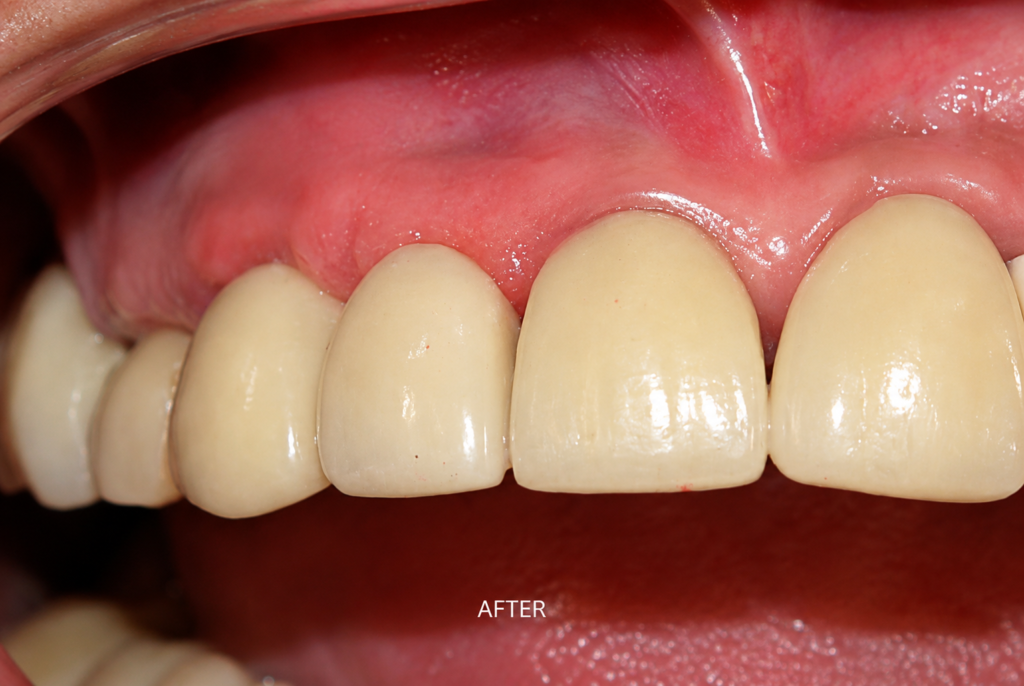 implant-uttara-dr. uttom